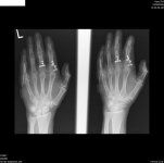hand2  xray x2.jpg