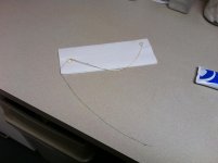 kidney stone stent.jpg